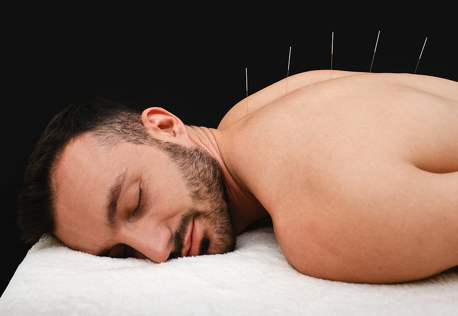 dry needling services